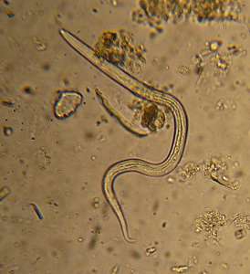 Wurm im Wasser mit kleineren Partikeln, hellem Hintergrund, Mikroskopaufnahme